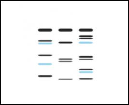 Gel documentation
